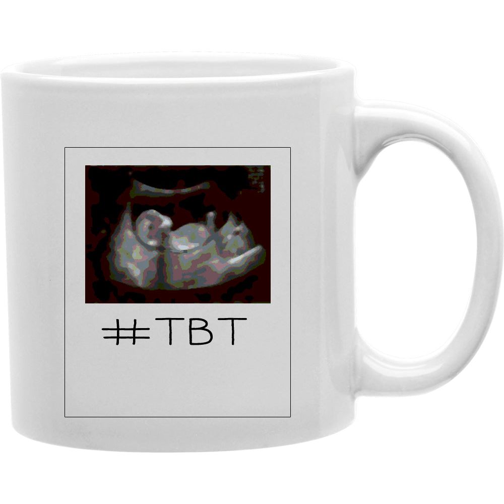 TBT Ultrasound  Coffee and Tea Ceramic  Mug 11oz